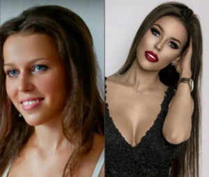 Татьяна Строкова до и после пластики фото